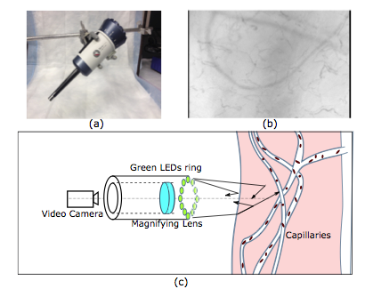 micro circulation