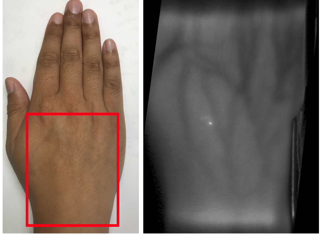 High Resolution Diffuse Optical Tomography using Short Range Indirect Subsurface Imaging