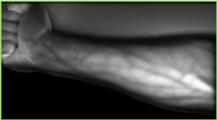 Plane-to-Ray Indirect Light Transport