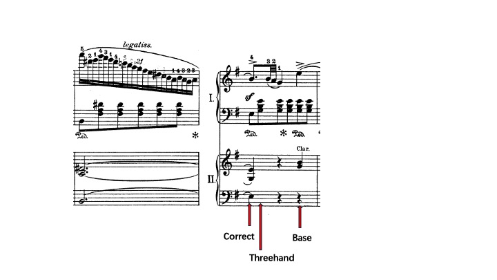 Chopin Piano Concerto No. 1 passage